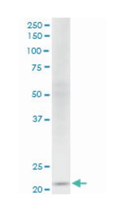 NDUFV2, Mouse, Clone: 1A10, Abnova 100&mu;g; Unlabeled:Antibodies, Monoclonal