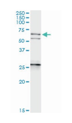 NEFL, Rabbit, MaxPab Polyclonal Antibody, Abnova 100&mu;L; Unlabeled:Antibodies,