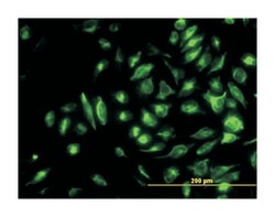 nonmetastatic cells 2, protein (NM23B) expressed in, Mouse, Clone: 1D3, Abnova 100 &mu;g | Buy Online | Abnova Corporation | Fisher Scientific