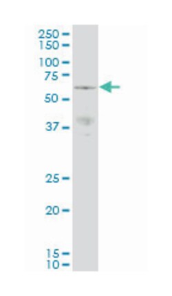 p21 protein (Cdc42/Rac)-activated kinase 3, Mouse, Clone: 1H7, Abnova 100&mu;g;