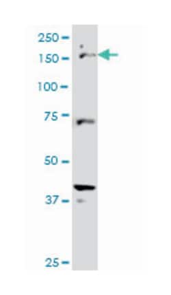 cut-like homeobox 1, Mouse, Clone: 2D10, Abnova 100&mu;g; Unlabeled:Antibodies,