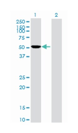 CYP2D6, Mouse, Purified MaxPab Polyclonal Antibody, Abnova 50&mu;g; Unlabeled:Antibodies,