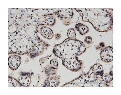 DGKA, Mouse, Clone: 2B7, Abnova 100&mu;g; Unlabeled:Antibodies, Monoclonal