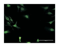 DCK, Mouse, Clone: 2F10, Abnova 100&mu;g; Unlabeled:Antibodies, Monoclonal