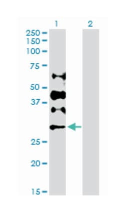 deoxycytidine kinase (D01P), Rabbit anti-Human, Purified MaxPab™ Polyclonal Antibody, Abnova™