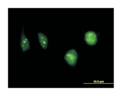 deoxycytidine kinase, Mouse, Clone: 1D12, Abnova 100&mu;g; Unlabeled:Antibodies,