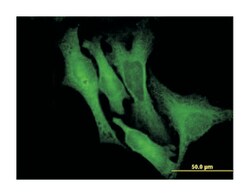 doublecortin, Mouse, Clone: 1G12, Abnova 100&mu;g; Unlabeled:Antibodies,