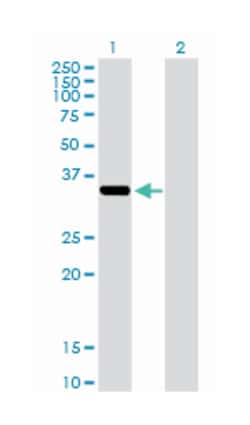 aldo-keto reductase family 1, member C2 (dihydrodiol dehydrogenase 2; bile
