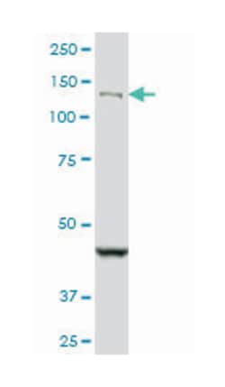 DHX8, Mouse, Clone: 1D6, Abnova 100&mu;g; Unlabeled:Antibodies, Monoclonal