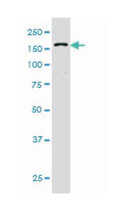 DHX9, Mouse, Clone: 3G7, Abnova 100 &mu;g | Buy Online | Abnova Corporation | Fisher Scientific