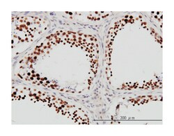 DHX9, Mouse, Clone: 3G7, Abnova 100 &mu;g | Buy Online | Abnova Corporation | Fisher Scientific