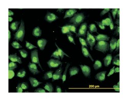 DHX9, Mouse, Clone: 3G7, Abnova 100 &mu;g | Buy Online | Abnova Corporation | Fisher Scientific