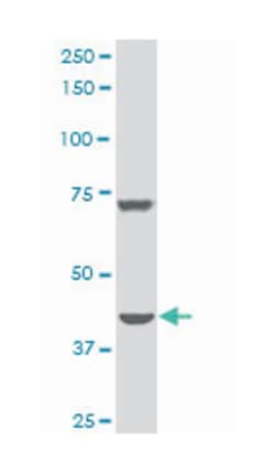 DEAD/H (Asp-Glu-Ala-Asp/His) box polypeptide 11 (CHL1-like helicase homolog,