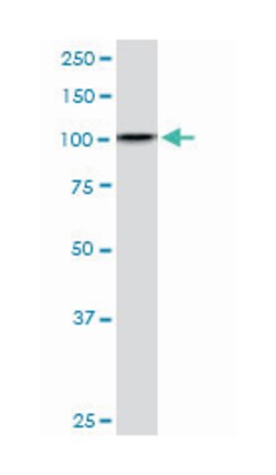 DDX11, Mouse, Clone: 3C1, Abnova 100&mu;g; Unlabeled:Antibodies, Monoclonal