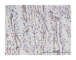 DDX11, Mouse, Clone: 3C1, Abnova 100&mu;g; Unlabeled:Antibodies, Monoclonal