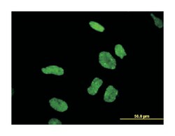 DDX11, Mouse, Clone: 3C1, Abnova 100&mu;g; Unlabeled:Antibodies, Monoclonal