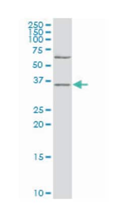 DNA fragmentation factor, 40kDa, beta polypeptide (caspase-activated DNase),
