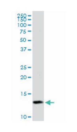 TIMM8A, Mouse, Purified MaxPab Polyclonal Antibody, Abnova 50&mu;g; Unlabeled:Antibodies,