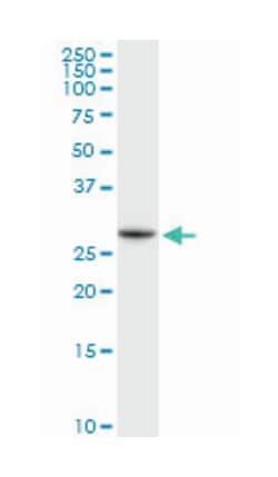 NAD(P)H dehydrogenase, quinone 1, Rabbit, Purified MaxPab™ Polyclonal Antibody, Abnova™