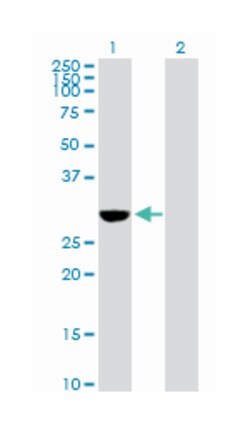 NAD(P)H dehydrogenase, quinone 1, Rabbit, Purified MaxPab Polyclonal Antibody,