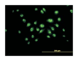 dyskeratosis congenita 1, dyskerin, Mouse, Purified MaxPab Polyclonal Antibody,