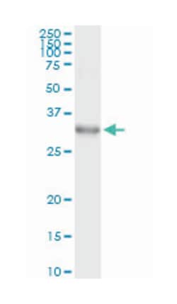 DLX1, Mouse, Clone: 2H3, Abnova 100&mu;g; Unlabeled:Antibodies, Monoclonal