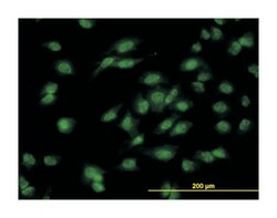 DLX1, Mouse, Clone: 2H3, Abnova 100&mu;g; Unlabeled:Antibodies, Monoclonal