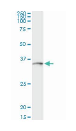 DLX1, Mouse, Clone: 4H7, Abnova 100&mu;g; Unlabeled:Antibodies, Monoclonal