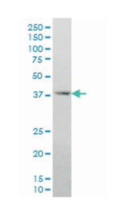 DLX2, Mouse, Clone: 2E12, Abnova 100&mu;g; Unlabeled:Antibodies, Monoclonal