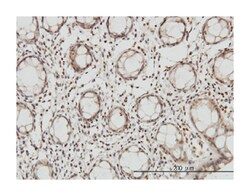 DLX2, Mouse, Clone: 2E12, Abnova 100&mu;g; Unlabeled:Antibodies, Monoclonal