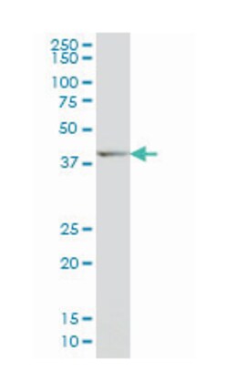 DLX2, Mouse, Clone: 2C8, Abnova 100&mu;g; Unlabeled:Antibodies, Monoclonal