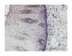 DLX2, Mouse, Clone: 2C8, Abnova 100&mu;g; Unlabeled:Antibodies, Monoclonal