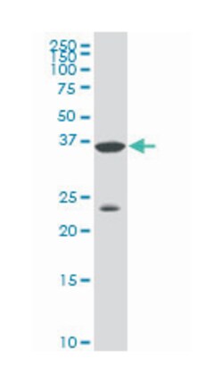 distal-less homeobox 3, Mouse, Clone: 3B8, Abnova 100 &mu;g | Buy Online | Abnova Corporation | Fisher Scientific