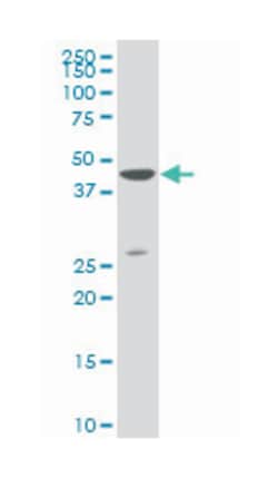 DLX3, Mouse, Clone: 3C3, Abnova 100&mu;g; Unlabeled:Antibodies, Monoclonal