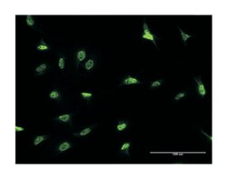DLX3, Mouse, Clone: 3F7, Abnova 100&mu;g; Unlabeled:Antibodies, Monoclonal