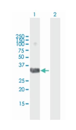 distal-less homeobox 4, Mouse, Polyclonal Antibody, Abnova 50 &mu;L | Buy Online | Abnova | Fisher Scientific