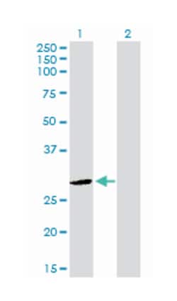 distal-less homeobox 4, Rabbit, Purified MaxPab Polyclonal Antibody, Abnova