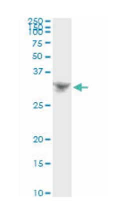 DLX4, Mouse, Clone: 1F11, Abnova 100&mu;g; Unlabeled:Antibodies, Monoclonal