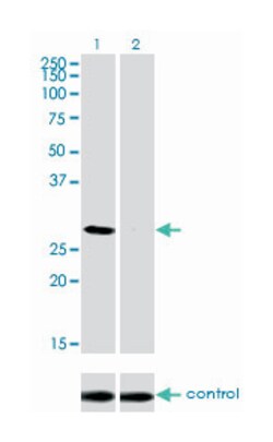 DLX4, Mouse, Clone: 1F11, Abnova 100&mu;g; Unlabeled:Antibodies, Monoclonal
