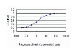 DLX4, Mouse, Clone: 1F11, Abnova 100&mu;g; Unlabeled:Antibodies, Monoclonal