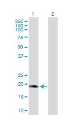 distal-less homeobox 6, Rabbit, Purified MaxPab Polyclonal Antibody, Abnova