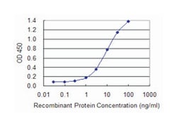 DLX6, Mouse, Clone: 2D7, Abnova 100 &mu;g | Buy Online | Abnova Corporation | Fisher Scientific
