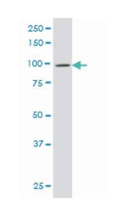 DNM2, Mouse, Clone: 6C9, Abnova 100&mu;g; Unlabeled:Antibodies, Monoclonal