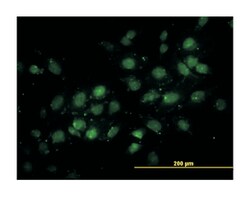 tRNA aspartic acid methyltransferase 1, Mouse, Clone: 1E12, Abnova 100&mu;g;