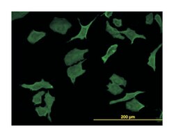 dihydropyrimidine dehydrogenase, Mouse, Clone: 7D4, Abnova 100&mu;g; Unlabeled:Antibodies,