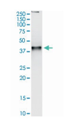 ARK2, Rabbit, MaxPab Polyclonal Antibody, Abnova 100 &mu;L | Buy Online | Abnova | Fisher Scientific