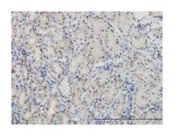 paired box 7, Mouse, Clone: 1E12, Abnova 100 &mu;g | Buy Online | Abnova Corporation | Fisher Scientific