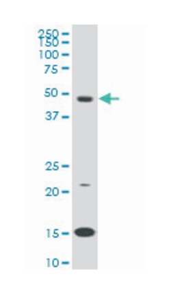 pre-B-cell leukemia homeobox 3, Mouse, Clone: 1A11, Abnova 100&mu;g; Unlabeled:Antibodies,