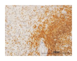 SLC26A3, Mouse, Clone: 2E3, Abnova 100 &mu;g | Buy Online | Abnova Corporation | Fisher Scientific