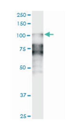 DSC2, Mouse, Clone: 1F2, Abnova 100&mu;g; Unlabeled:Antibodies, Monoclonal